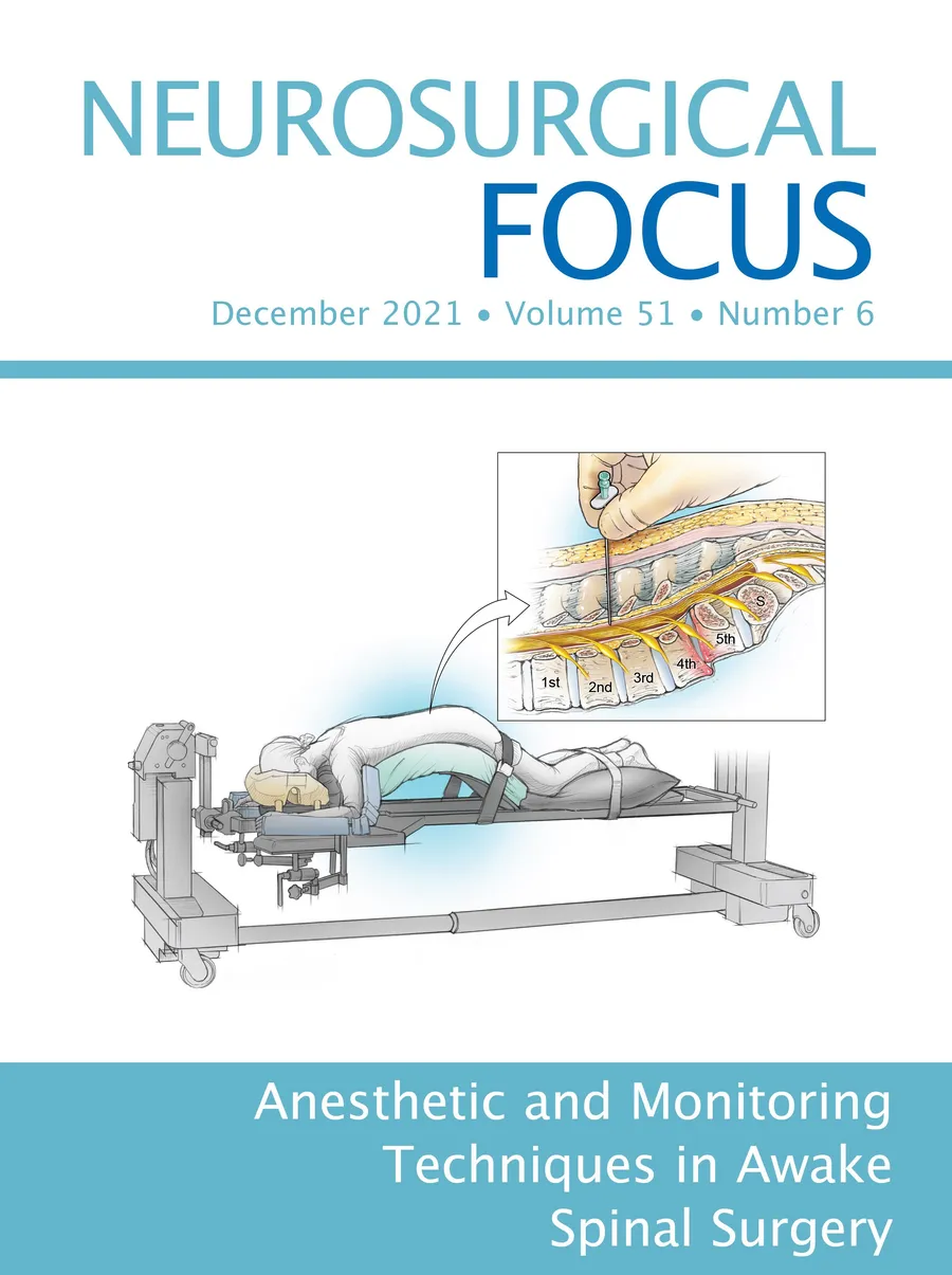Cover of Neurosurgical Focus, December 2021, Volume 51, Number 6, on anesthetic and monitoring techniques in awake spinal surgery