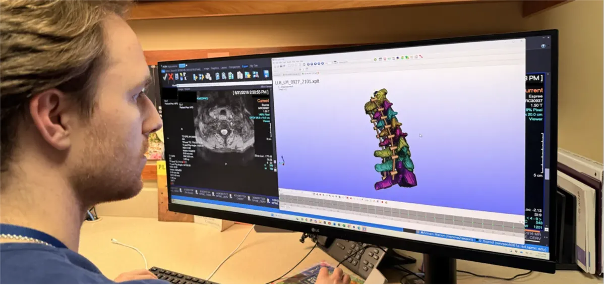 Postdoctoral research fellow working on spine finite element modeling
