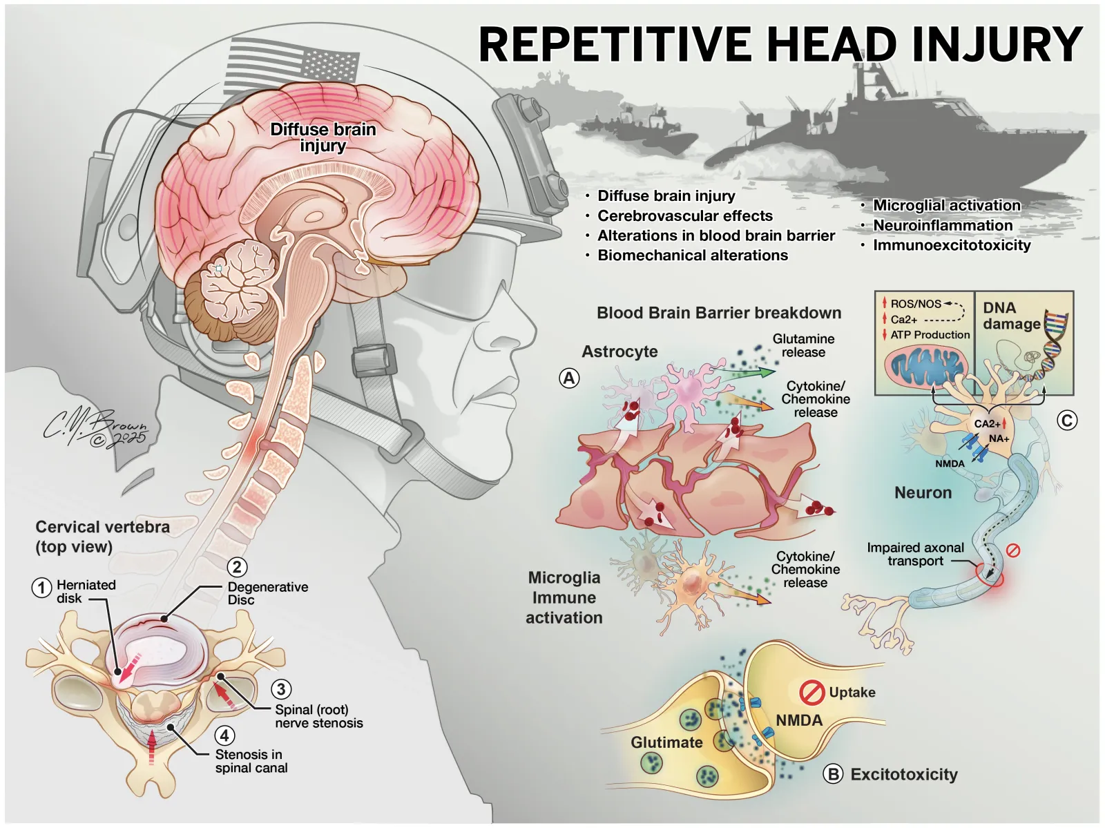 Illustration of repetitive head injury, showing diffuse brain injury, cervical spine degeneration, blood brain barrier breakdown, microglial activation, excitotoxicity, and impaired axonal transport