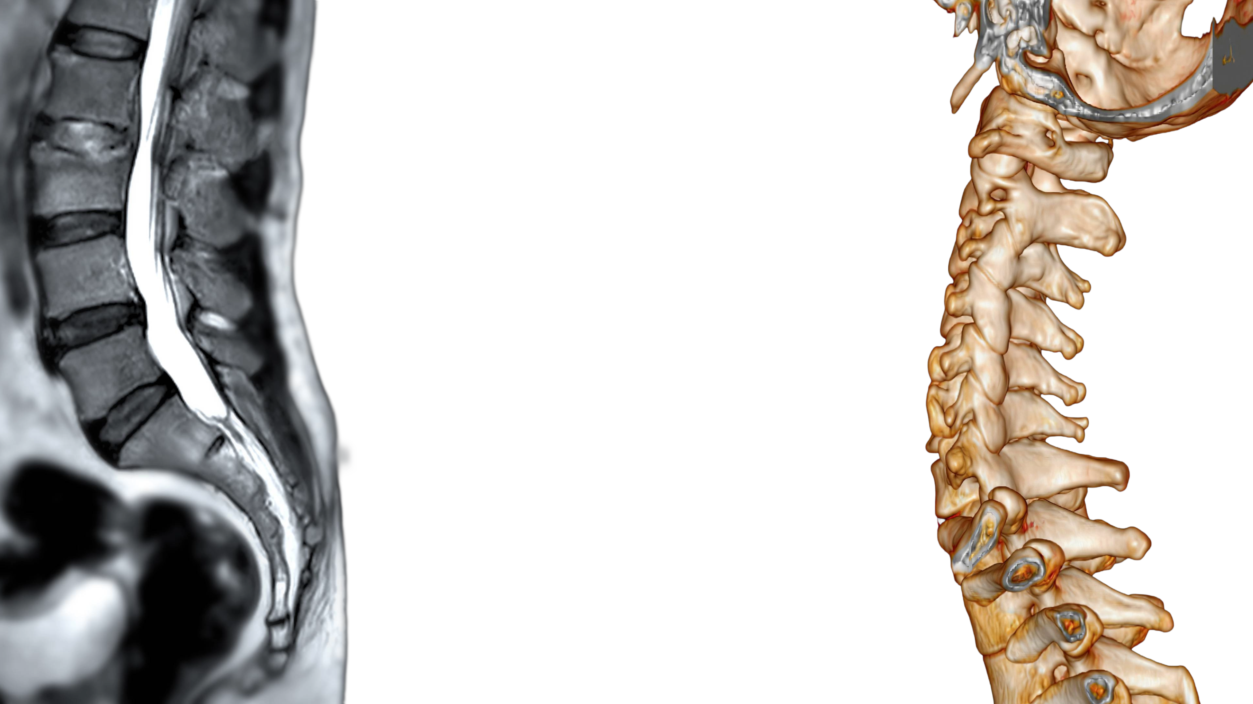 Medical imaging collage showing spine and skeletal structures